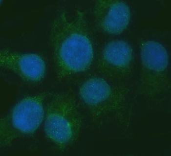 Anti-RGS7 Antibody