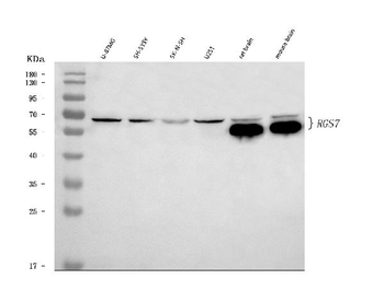 Anti-RGS7 Antibody