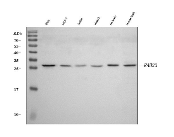 Anti-RAB23 Antibody