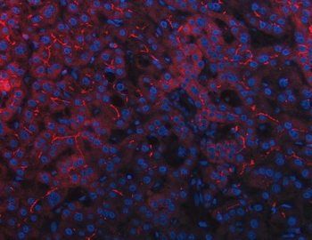 Anti-DEP1/PTPRJ Antibody