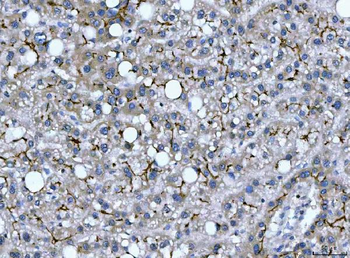 Anti-DEP1/PTPRJ Antibody