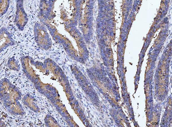 Anti-DEP1/PTPRJ Antibody