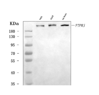 Anti-DEP1/PTPRJ Antibody