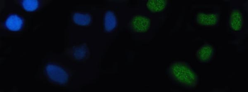 Anti-Nkx2.5/NKX2-5 Antibody