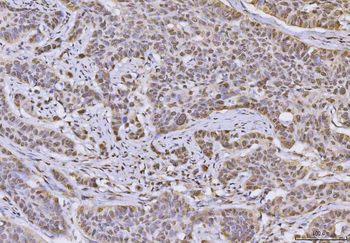 Anti-hnRNP U/p120/HNRNPU Antibody