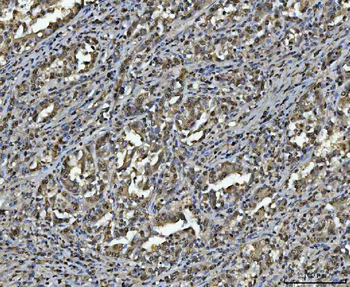 Anti-hnRNP U/p120/HNRNPU Antibody