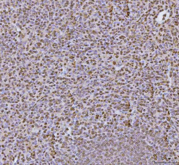 Anti-hnRNP U/p120/HNRNPU Antibody