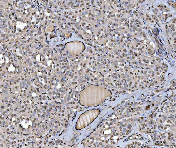Anti-hnRNP U/p120/HNRNPU Antibody