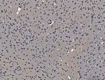 Anti-hnRNP U/p120/HNRNPU Antibody