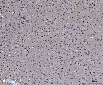 Anti-hnRNP U/p120/HNRNPU Antibody