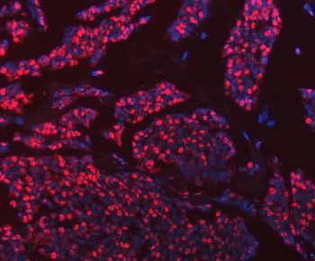 Anti-hnRNP U/p120/HNRNPU Antibody