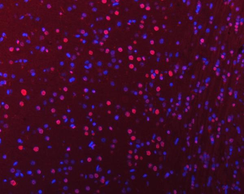 Anti-hnRNP U/p120/HNRNPU Antibody