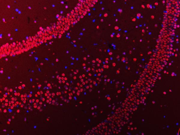 Anti-hnRNP U/p120/HNRNPU Antibody