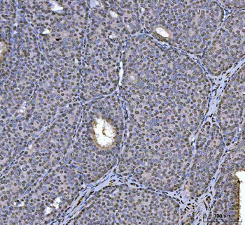 Anti-hnRNP U/p120/HNRNPU Antibody