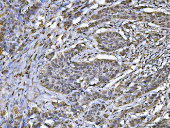 Anti-hnRNP U/p120/HNRNPU Antibody