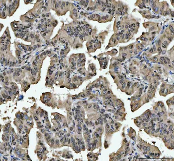 Anti-hnRNP L/HNRNPL Antibody