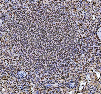 Anti-hnRNP L/HNRNPL Antibody