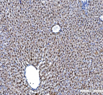 Anti-hnRNP L/HNRNPL Antibody
