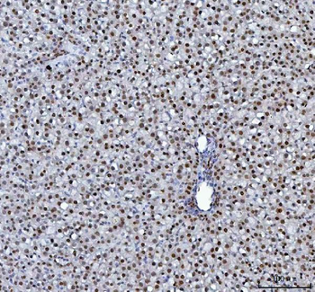 Anti-hnRNP L/HNRNPL Antibody