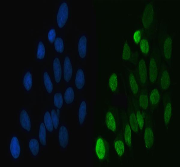 Anti-hnRNP L/HNRNPL Antibody