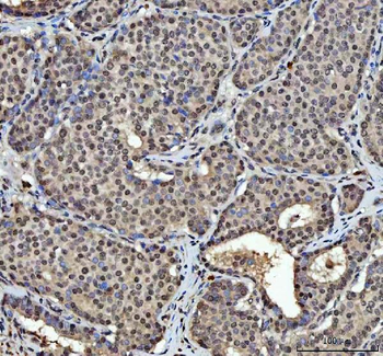 Anti-hnRNP L/HNRNPL Antibody