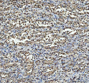 Anti-hnRNP L/HNRNPL Antibody