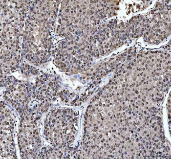 Anti-hnRNP L/HNRNPL Antibody