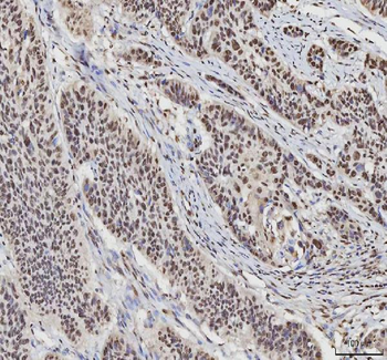 Anti-hnRNP L/HNRNPL Antibody