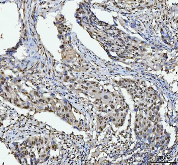 Anti-hnRNP L/HNRNPL Antibody