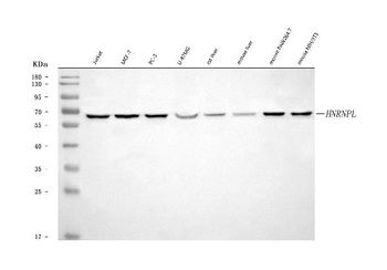 hnRNP L/HNRNPL Antibody