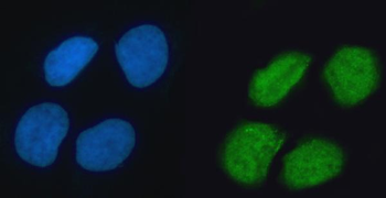 Anti-hnRNP K/HNRNPK Antibody