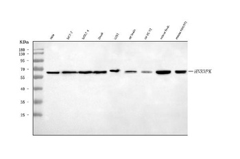 hnRNP K/HNRNPK Antibody