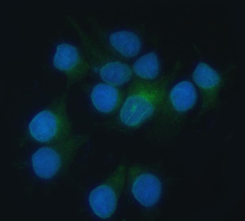 Anti-Heme oxygenase 2/HMOX2 Antibody