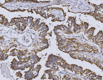 Anti-Heme oxygenase 2/HMOX2 Antibody