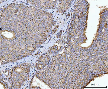 Anti-HMGCR Antibody