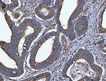 Anti-HMGCR Antibody