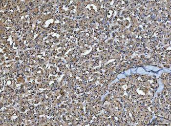 Anti-HMGCR Antibody