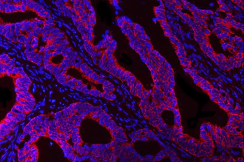 Anti-DTR/HBEGF Antibody