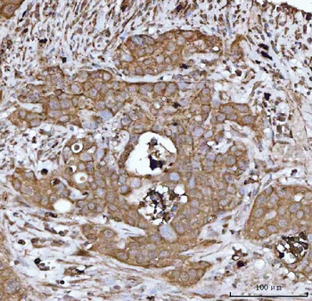 Anti-DTR/HBEGF Antibody