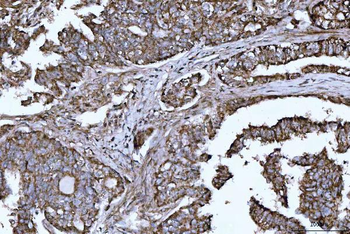 Anti-DTR/HBEGF Antibody