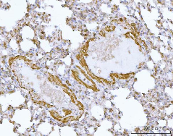 Anti-DTR/HBEGF Antibody