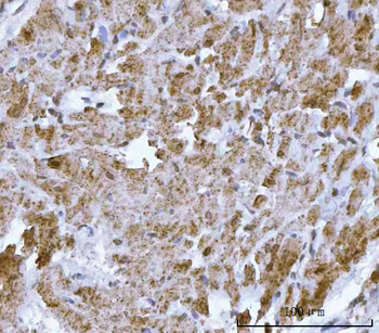 Anti-DTR/HBEGF Antibody