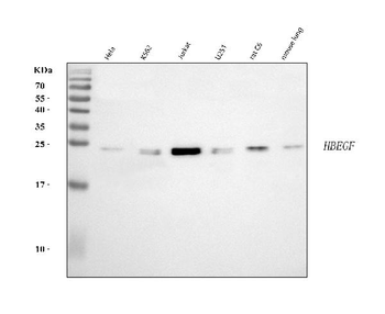 Anti-DTR/HBEGF Antibody