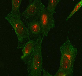 GSK3 beta/GSK3B Antibody