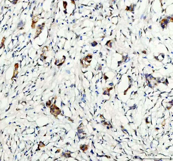 Anti-GSK3 beta/GSK3B Antibody