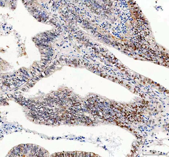 Anti-GSK3 beta/GSK3B Antibody