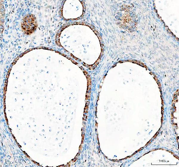 Anti-GSK3 beta/GSK3B Antibody