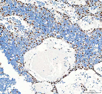Anti-GSK3 beta/GSK3B Antibody