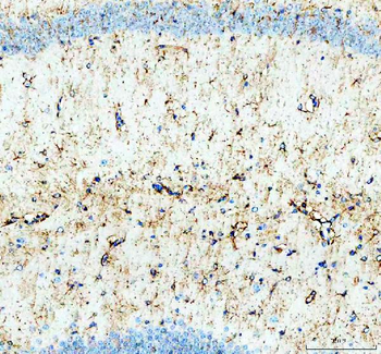 Anti-GSK3 beta/GSK3B Antibody