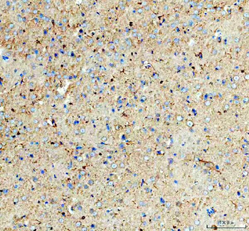 Anti-GSK3 beta/GSK3B Antibody